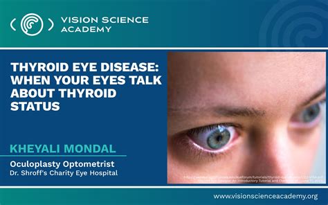 Progression of thyroid eye disease | thyroid eye disease treatment – Akapv