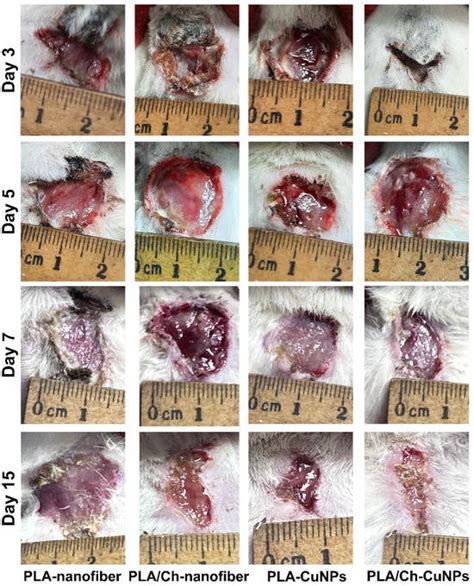 Copper Nanoparticle Loaded Electrospun Patches for Infected Wound ...