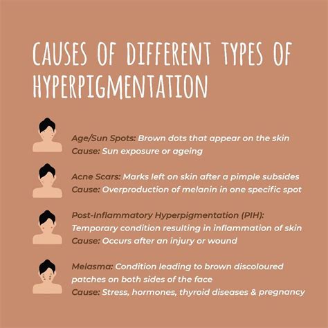 Hyperpigmentation unravelled what causes it and how should you treat it ...