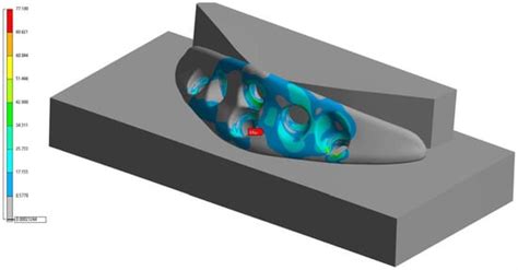 Craniomaxillofacial Trauma & Reconstruction | An Open Access Journal ...