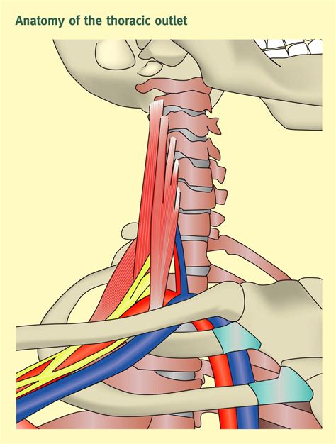 Thoracic outlet syndrome - Surgery - Oxford International Edition