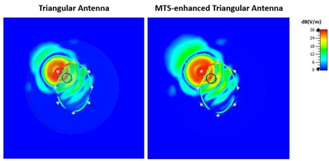 Metasurface-Enhanced Antennas for Microwave Brain Imaging