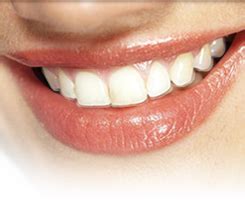 Types of Braces | Orthodontic Associates of Collegeville | Collegeville ...