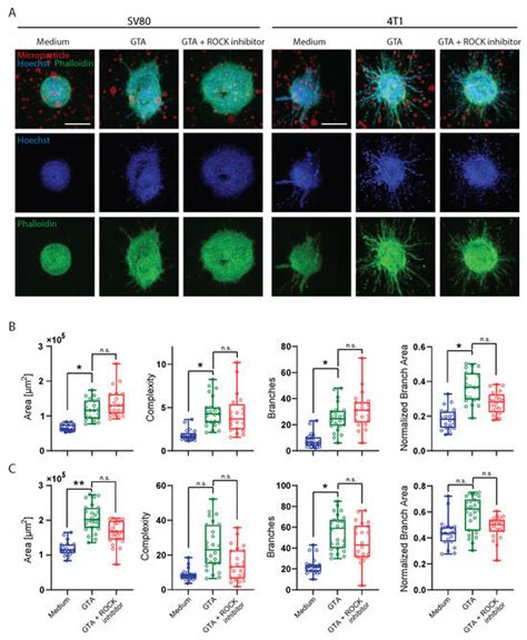 Matrix Stiffness Affects Spheroid Invasion, Collagen Remodeling, and ...