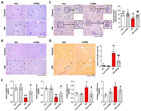 Identification of Common Genes Regulated by ER Stress During the ...