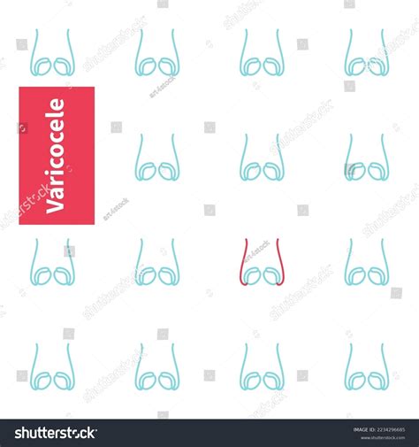 454 Anatomy Male Reproductive Sperm Diagram Images, Stock Photos & Vectors | Shutterstock - anatomy of penis enlargement diagram