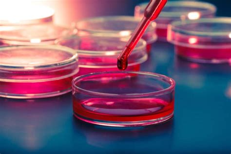 Prolactin Test: प्रोलैक्टिन टेस्ट क्या है? प्रक्रिया, टेस्ट से पहले ...