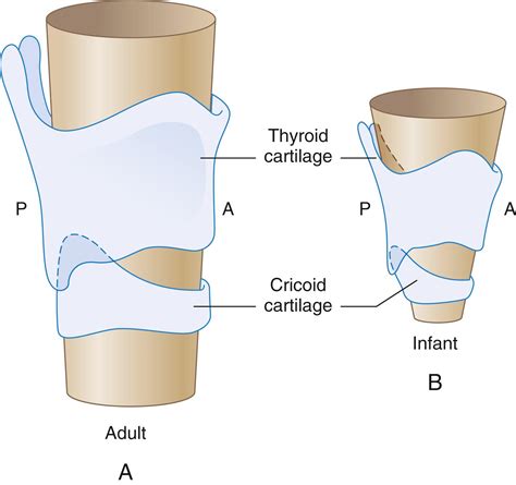 Pediatric Anesthesia 的图像结果