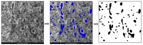 A 1-Month Ketogenic Diet Increased Mitochondrial Mass in Red ...