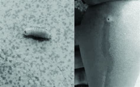 How Do Maggots Form In Body at Jeffrey Mesa blog