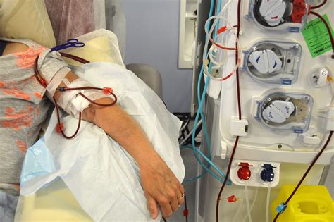 Pictures About Dialysis
