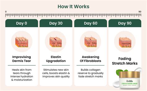 Healofy Stretch Marks Cream - Visible Results in 28 Days | Advanced ...