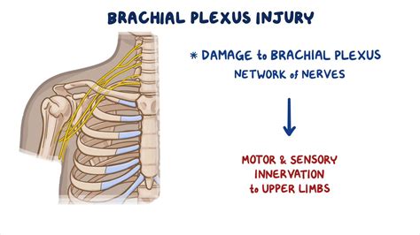 Brachial plexus injury: Nursing - Osmosis Video Library