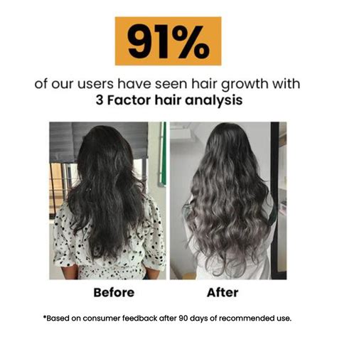 Ayurvedic Hair Oil For Hair Growth with Free Heater | 50ml – Tru Hair ...