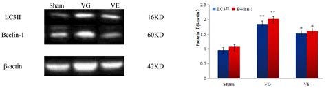 The Mechanism of Aerobic Exercise Regulating the PI3K/Akt-mTOR ...
