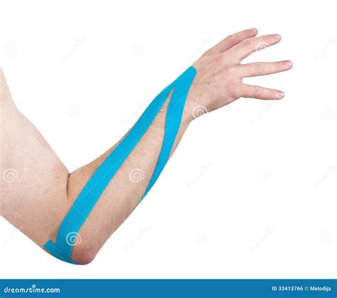 Kinesio Tex Tape Therapeutic Treatment of the Elbow Stock Photo - Image ...