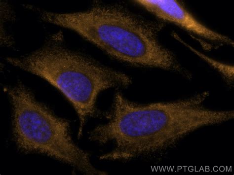 CDK6 antibody (CL555-66278) | Proteintech