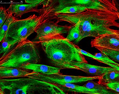 Confocal Microscopy | Edmund Optics