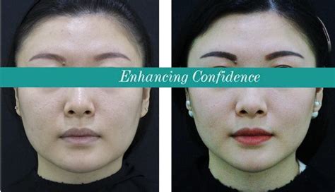 Image result for Face Threads