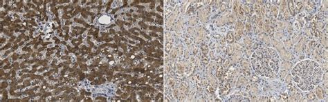 COA Search Results - India