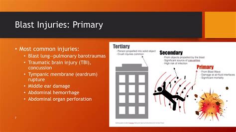 Blast Injury Management.pptx