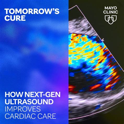 Understanding your heart test: What to expect, how to prepare - Mayo ...