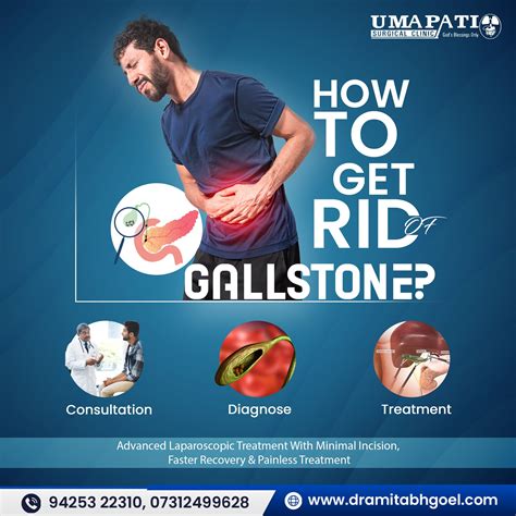 How to get rid of gallstone – Artofit