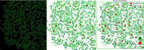Enhanced HoVerNet Optimization for Precise Nuclei Segmentation in ...