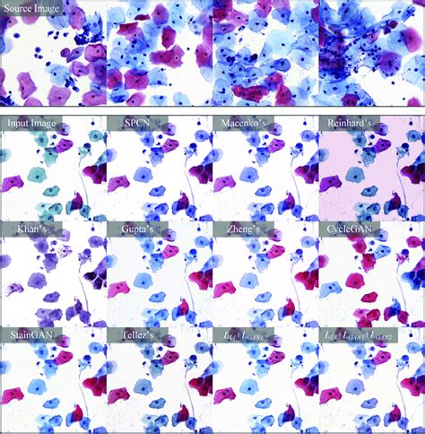 Image result for Normalized