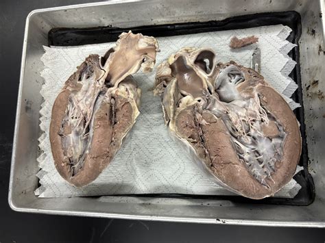 Image result for Heart Dissection Tutorial