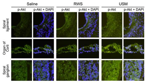 Ultrasound Microbubbles Enhance the Efficacy of Insulin-Like Growth ...
