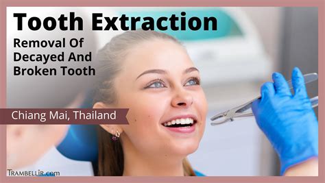 Image result for Broken Tooth Extraction