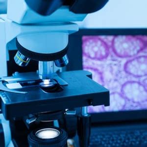 Pathology | Bezwada Hospitals