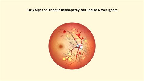 Early Signs of Diabetic Retinopathy You Should Never Ignore