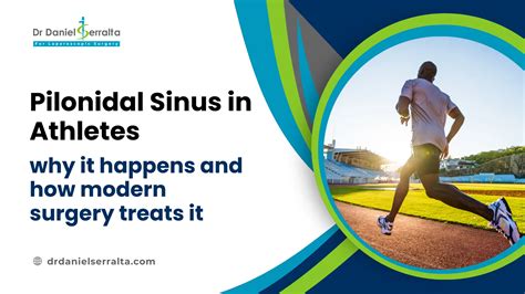Pilonidal Cyst Vs Pilonidal Sinus: Understanding Key Differences