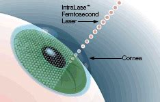 TMS EYE HOSPITAL - Best Eye Hospital in Salem, Children Eye Specialist ...