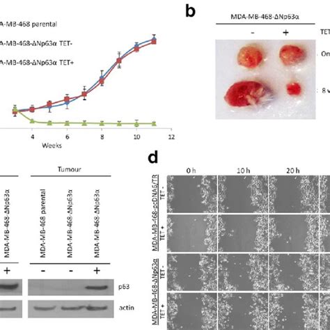 MicroRNA‑449a inhibits cell proliferation and migration by regulating ...