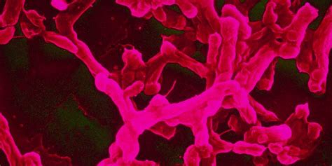 Typhoid-Causing Bacteria are Becoming More Resistant to Essential ...