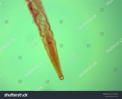 Necator Americanus Labeled