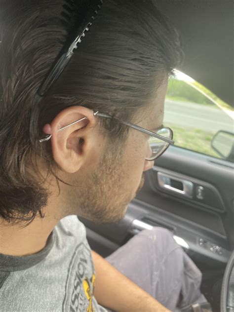 How to know if keloid or irritation bump? : r/piercing