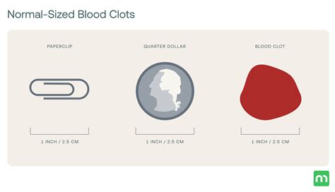 Golf Ball-Sized Blood Clots During Period: 12 Possible Causes – Mira Fertility Shop