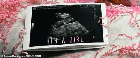 Image result for Alien Baby Ultrasound Scene