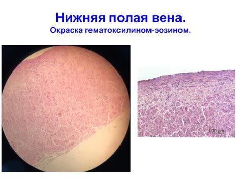 Легкое. Респираторный отдел. Окраска гематоксилином-эозином