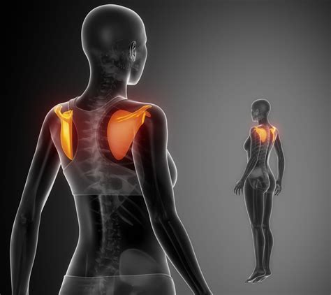 Shoulder blade muscle pain & spasm: Rhomboid muscle spasm