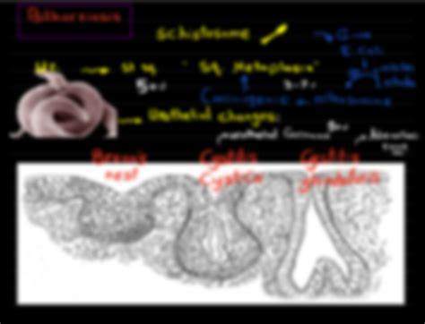 SOLUTION: Urinary bladder diverticula acute chronic cystitis bilharziasis urothelial carcinoma ...