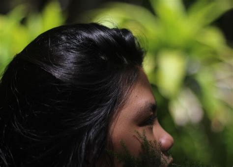 Everything You Need To Know About Scalp Psoriasis in Ayurveda | Vedam ...