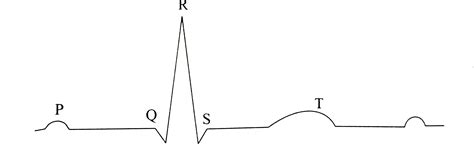 In this figure, peak point (a) is represented by letter