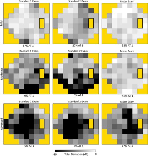 Image result for Check Visual Fields