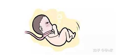 胎儿脐带打结怎么回事？跟睡姿有关吗？__凤凰网