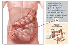 come fare un clistere a casa home pulizia intestinale pulizia intestinale come fare un clistere a casa home pulizia intestinale pulizia intestinale